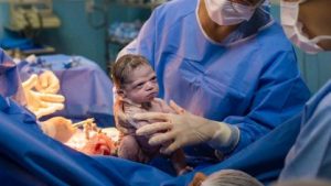 Bebê nasce com cara de ‘brava’ e imagem viraliza na internet