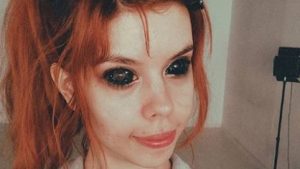Mulher perde quase toda a visão após fazer tatuagem para pintar os olhos de preto