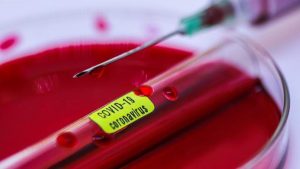 Coronavírus: Hospital de SP confirma mais duas mortes
