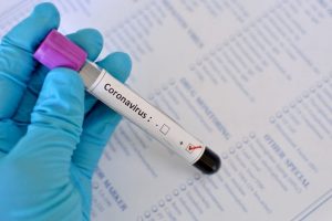 Morre quinta vítima de coronavírus no DF