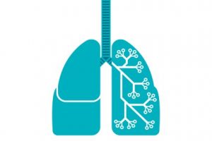 Câncer de pulmão: mudanças no diagnóstico e no tratamento