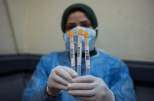Coronavírus: testes rápidos poderão chegar ao Brasil em abril