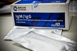 Saúde abre pregão para compra de 1 milhão de testes rápidos