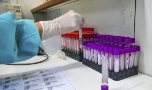 Coronavac: Estudo chinês mostra que vacina não provocou efeitos colaterais