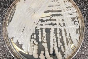 Brasil registra primeiro caso de Candida auris