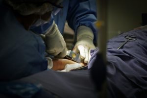 Criança de três anos passa por transplante de pele no Hran