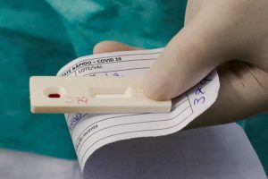 Covid-19: média móvel de casos vai a 150 mil e bate novo recorde