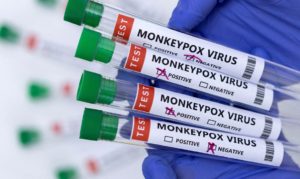 Monkeypox: conheça as principais características, sintomas e tratamento da doença