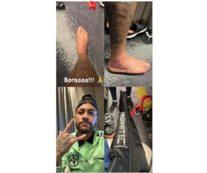 Neymar e Danilo fora da copa; ortopedista explica o que é entorse