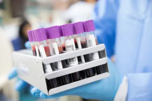 CCJ do Senado deve votar hoje a PEC da coleta e comercialização de plasma sanguíneo no Brasil