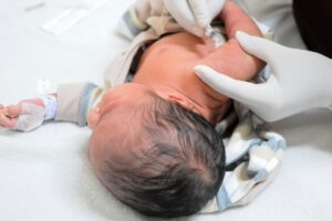 Vacina BCG em recém-nascidos é essencial contra tuberculose