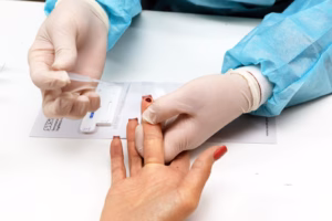 Luta contra o HIV: Saúde leva testagem rápida e orientações ao Setor Comercial Sul